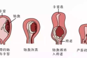 产后恢复指南：产后多久能穿瘦身衣-时间与注意事项解析