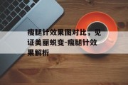 瘦腿针效果图对比，见证美丽蜕变-瘦腿针效果解析