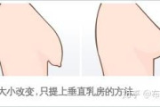 胸部下垂矫正方法-恢复紧致弹性解析
