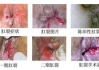 新冠咳嗽持续时间解析-常见症状与恢复时间