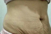 Latoja瘦身乳使用频率,如何合理安排-Latoja瘦身乳使用指南