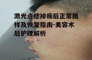 激光点痣掉痂后正常图样及恢复指南-美容术后护理解析