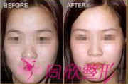 黑脸娃娃美容频率解析-多久做一次效果最佳