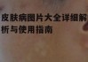 皮肤病图片大全详细解析与使用指南