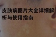 皮肤病图片大全详细解析与使用指南