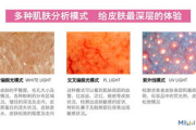 皮肤检测,科学护肤第一步-全面了解皮肤状况