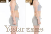 杭州瘦身整形医院,专业整形美容服务-杭州整形医院排名解析