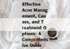 Effective Acne Management, Causes, and Treatment Options- A Comprehensive Guide