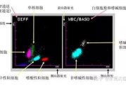 瘦身仪使用时长与效果评估-科学使用瘦身仪的正确方法解析