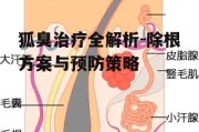 狐臭治疗全解析-除根方案与预防策略
