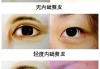 开后眼角手术前后照片对比-美容整形效果解析