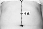 网上贴肚脐瘦身产品效果探究-真相与误区解析