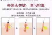 男士去黑头,专业护肤策略-轻松解决黑头烦恼