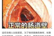 soso瘦身糖果片效果解析-减肥新选择