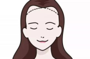 发际线调整后悔原因及应对策略-完美发型的再思考