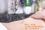 针灸减肥瘦身,传统中医的现代化解决方案