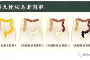 三步瘦身灸，传统中医减肥新选择