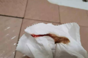 女生流出白色分泌物怎么回事,常见原因与处理指南