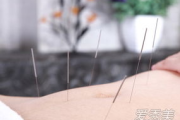 瘦身针灸贴,传统中医与现代科技的完美结合-体重管理新选择