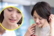 郑爽嘴角伤疤真相揭秘-原因分析及影响探究