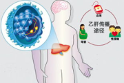 乙肝传播途径与预防措施-全面解析乙肝传染方式