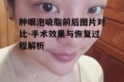 肿眼泡吸脂前后图片对比-手术效果与恢复过程解析