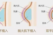 瘦身对胸部大小的影响探究-减肥与胸型变化分析