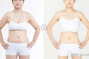 韩国溶脂减肥瘦身贴，安全高效-减肥瘦身新选择