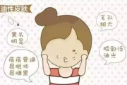 油性皮肤去油小窍门-告别油光困扰