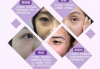 眼膜使用指南，呵护双眼焕发青春-常见问题与解决方案解析