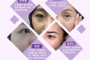 眼膜使用指南，呵护双眼焕发青春-常见问题与解决方案解析