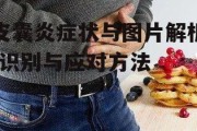 皮囊炎症状与图片解析-识别与应对方法