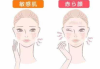 敏感肌肤护肤品选择指南-温和护理与成分解析