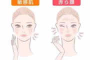 敏感肌肤护肤品选择指南-温和护理与成分解析