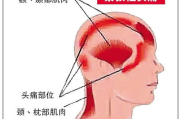 头疼怎么样可以缓解,全面解析头痛缓解方法与预防策略