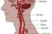 血管神经性头痛的症状与治疗策略-全面解析