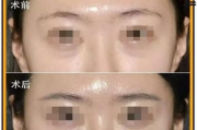 彩妆遮瑕技巧，告别黑眼圈-遮瑕产品选择与使用方法解析