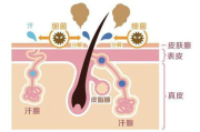 腋下有异味，如何判断是不是狐臭？- 狐臭识别与应对策略