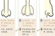 桃花痣识别与美学运用-美丽秘诀解析
