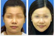 瘦身与瘦脸的关系，影响因素及建议