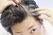 头发乌黑亮丽,护理秘诀-解决方案解析