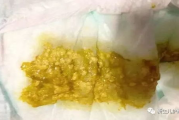 磁力bt种子搜索技巧与实践指南