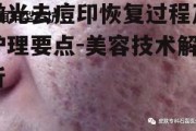 激光去痘印恢复过程及护理要点-美容技术解析