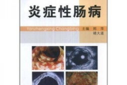 克罗恩病和溃疡性结肠炎的区别,炎症性肠病全面对比分析