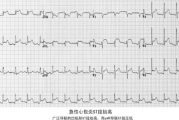男士高档纯棉睡衣选购指南-舒适与品质的完美结合