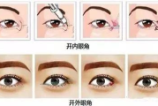 开眼角手术效果展示-前后对比照片图解析