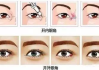 开眼角手术全解析-美容整形新选择
