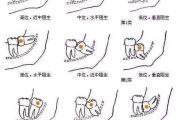 拔智齿瘦脸对比图分析-效果与事实揭秘