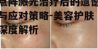 一、点阵激光治疗的原理与效果