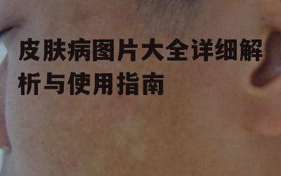 一、皮肤病图片大全的作用与价值